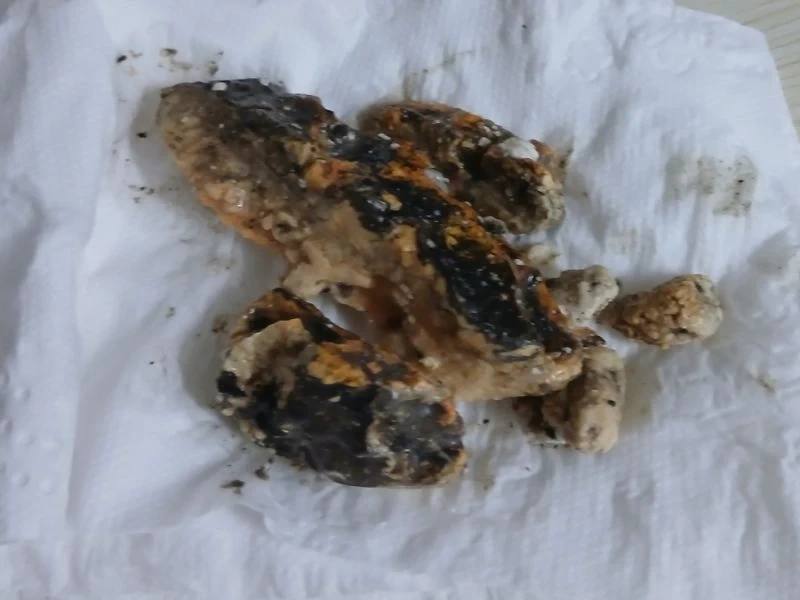 산본 변기 이물질 제거 사례 3